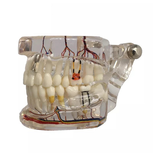 Dental Pathology Model