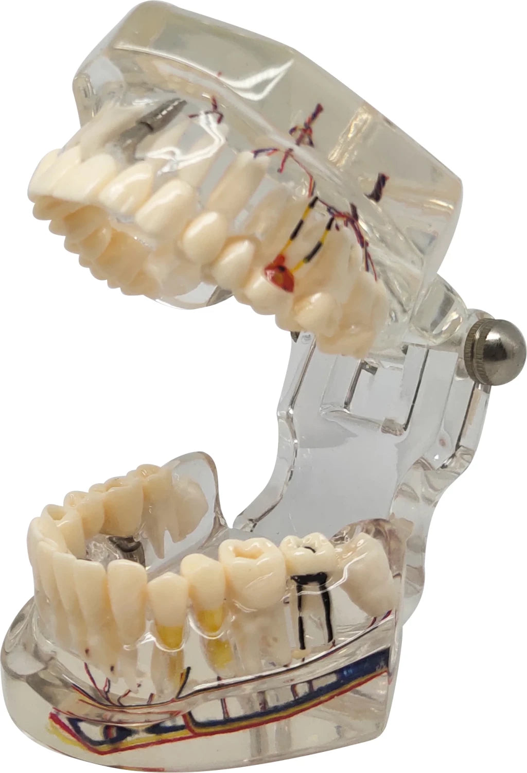 Dental Pathology Model